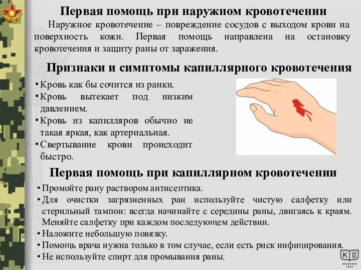 Первая помощь при капиллярном кровотечении Промойте рану раствором антисептика. Для очистки загрязненных