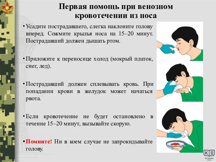 Первая помощь при венозном кровотечении из носа Усадите пострадавшего, слегка наклоните голову