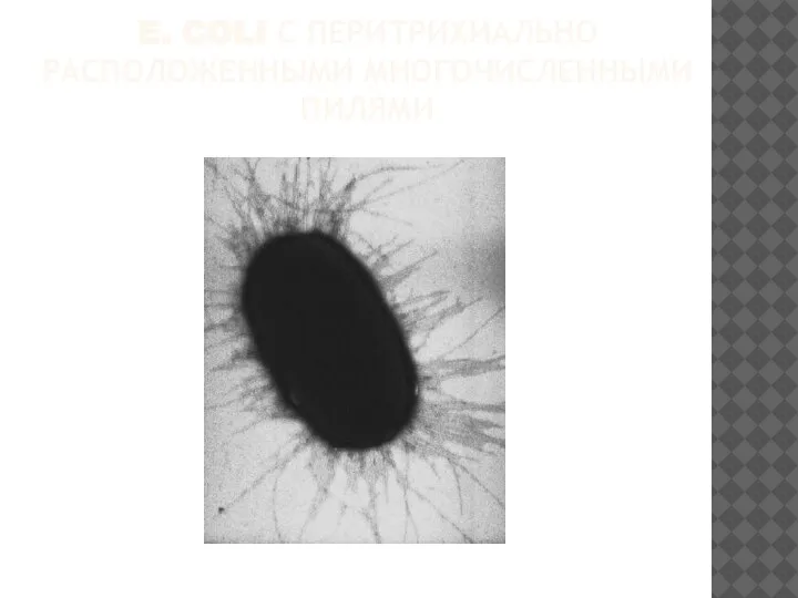 E. COLI С ПЕРИТРИХИАЛЬНО РАСПОЛОЖЕННЫМИ МНОГОЧИСЛЕННЫМИ ПИЛЯМИ