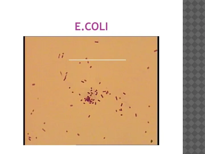 E.COLI