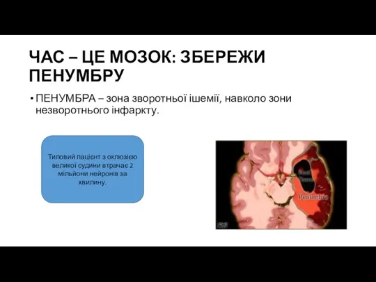 ЧАС – ЦЕ МОЗОК: ЗБЕРЕЖИ ПЕНУМБРУ ПЕНУМБРА – зона зворотньої ішемії, навколо