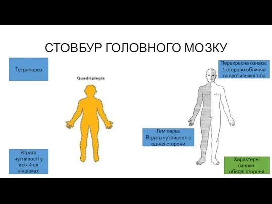 СТОВБУР ГОЛОВНОГО МОЗКУ Тетрапарез Втрата чутливості у всіх 4-ох кінцівках Перехресна ознака: