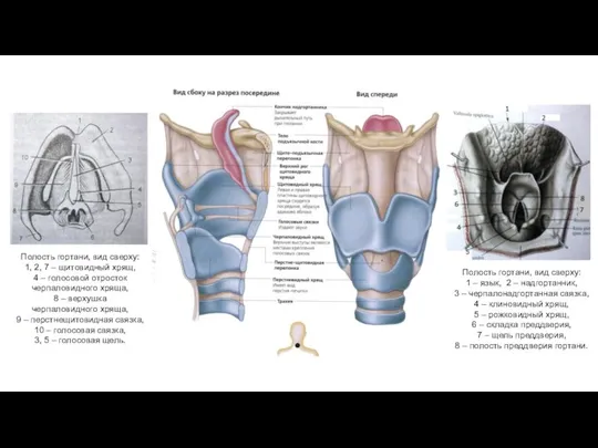 Полость гортани, вид сверху: 1, 2, 7 – щитовидный хрящ, 4 –