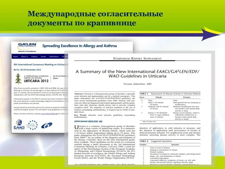 2013/02-062 Международные согласительные документы по крапивнице