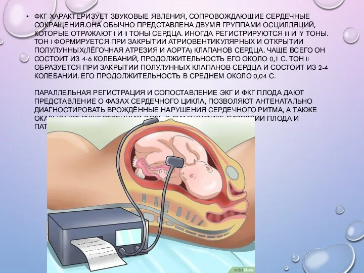 ФКГ ХАРАКТЕРИЗУЕТ ЗВУКОВЫЕ ЯВЛЕНИЯ, СОПРОВОЖДАЮЩИЕ СЕРДЕЧНЫЕ СОКРАЩЕНИЯ.ОНА ОБЫЧНО ПРЕДСТАВЛЕНА ДВУМЯ ГРУППАМИ ОСЦИЛЛЯЦИЙ,