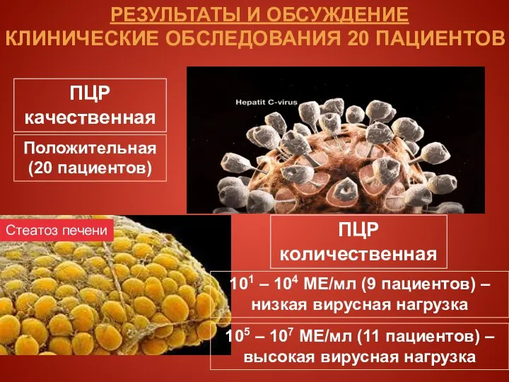 РЕЗУЛЬТАТЫ И ОБСУЖДЕНИЕ КЛИНИЧЕСКИЕ ОБСЛЕДОВАНИЯ 20 ПАЦИЕНТОВ ПЦР качественная Положительная (20 пациентов)