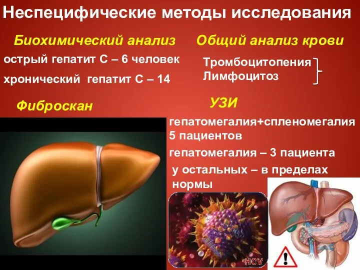 Неспецифические методы исследования Биохимический анализ острый гепатит С – 6 человек хронический