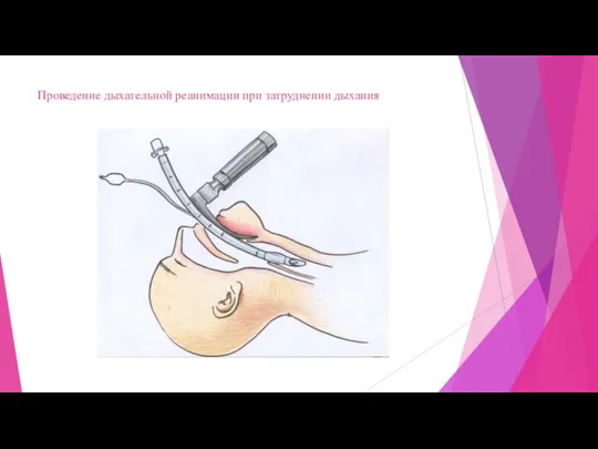 Проведение дыхательной реанимации при затруднении дыхания