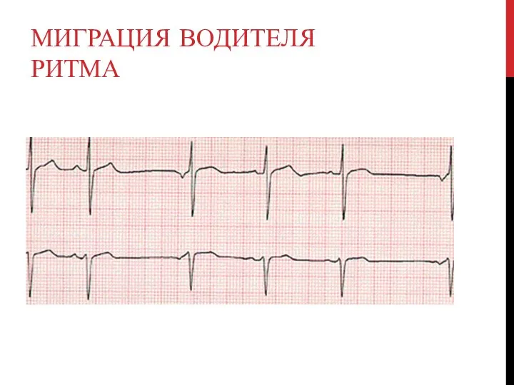 МИГРАЦИЯ ВОДИТЕЛЯ РИТМА