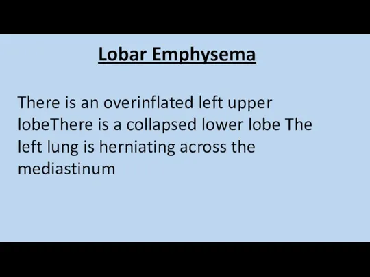 Lobar Emphysema There is an overinflated left upper lobeThere is a collapsed