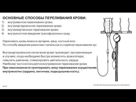 ОСНОВНЫЕ СПОСОБЫ ПЕРЕЛИВАНИЯ КРОВИ: внутривенное переливание крови; внутриартериальное переливание крови; внутриаортальное переливание