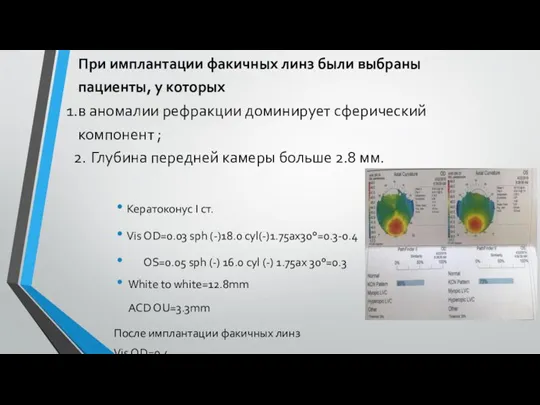 При имплантации факичных линз были выбраны пациенты, у которых в аномалии рефракции