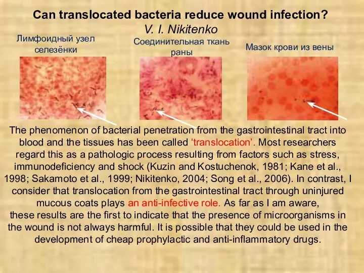 Can translocated bacteria reduce wound infection? V. I. Nikitenko The phenomenon of