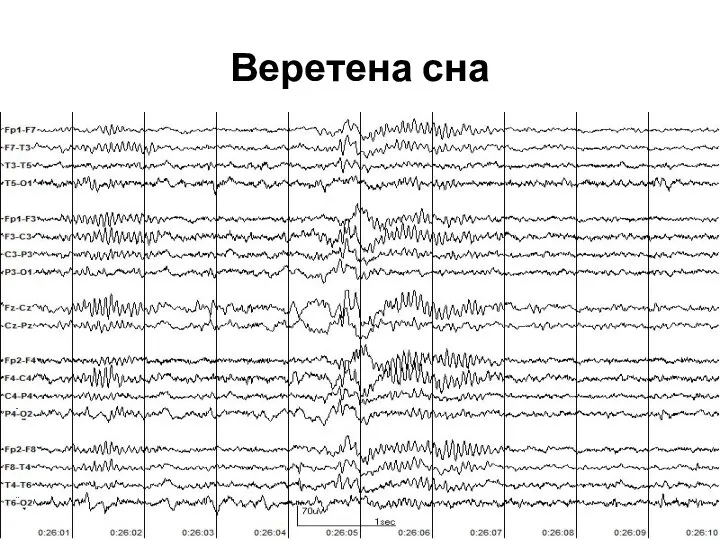 Веретена сна