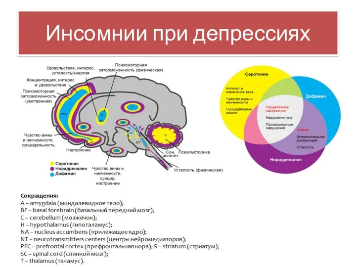 Инсомнии при депрессиях