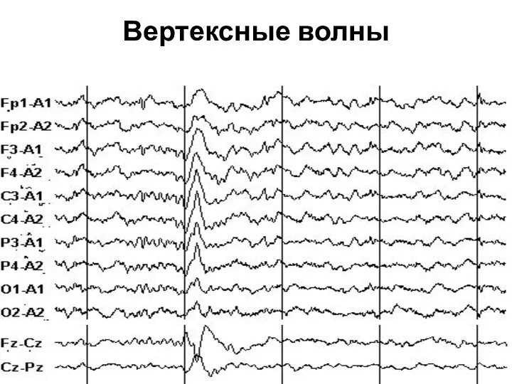 Вертексные волны