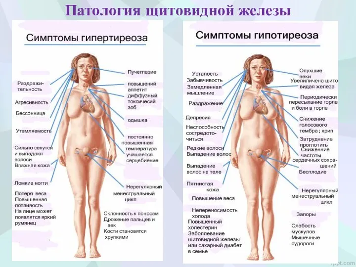 Патология щитовидной железы