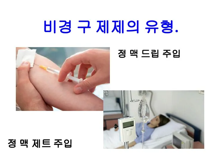 비경 구 제제의 유형. 정 맥 드립 주입 정 맥 제트 주입