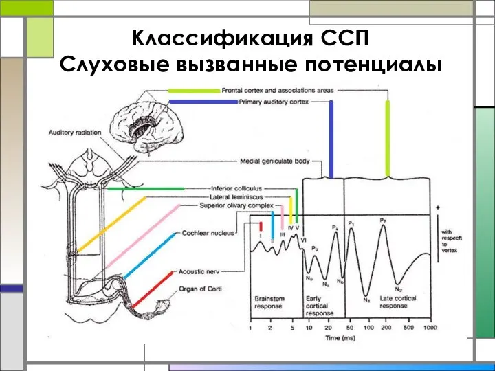 Классификация ССП Слуховые вызванные потенциалы