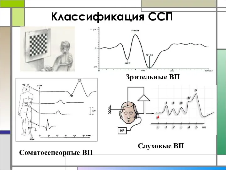 Классификация ССП Слуховые ВП Зрительные ВП Соматосенсорные ВП