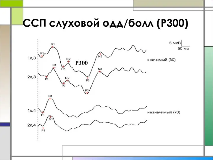 ССП слуховой одд/болл (Р300) Р300