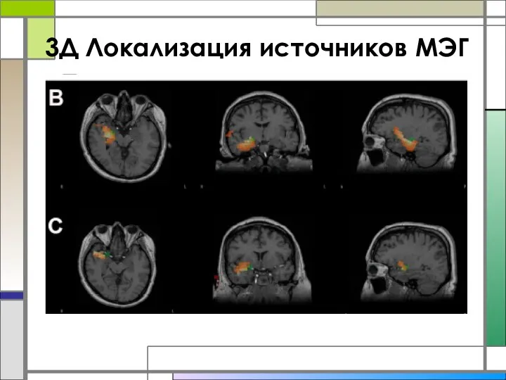 3Д Локализация источников МЭГ