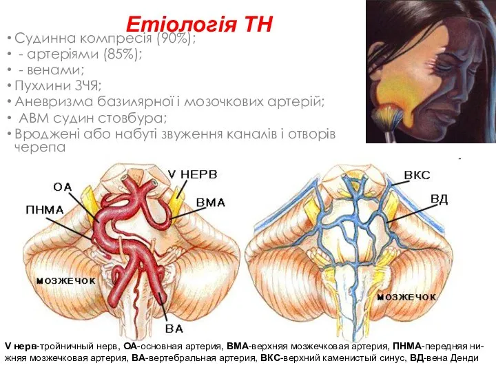 Етіологія ТН Судинна компресія (90%); - артеріями (85%); - венами; Пухлини ЗЧЯ;