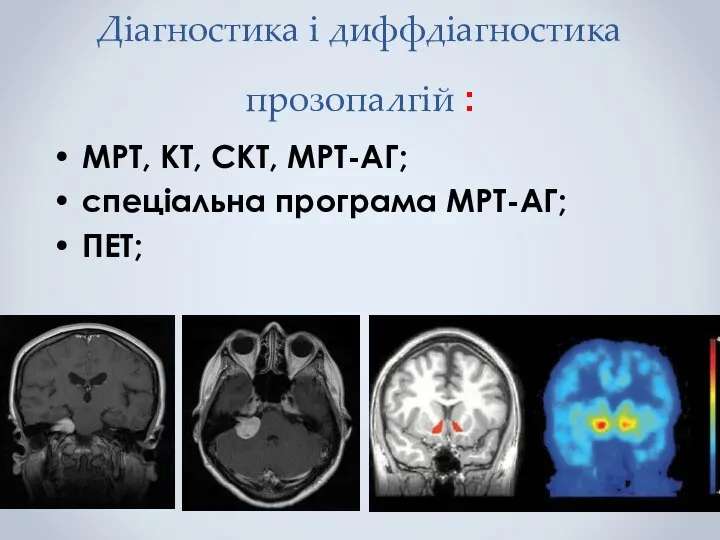 Діагностика і диффдіагностика прозопалгій : МРТ, КТ, СКТ, МРТ-АГ; спеціальна програма МРТ-АГ; ПЕТ;