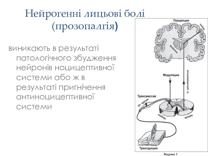 Нейрогенні лицьові болі (прозопалгія) виникають в результаті патологічного збудження нейронів ноцицептивної системи