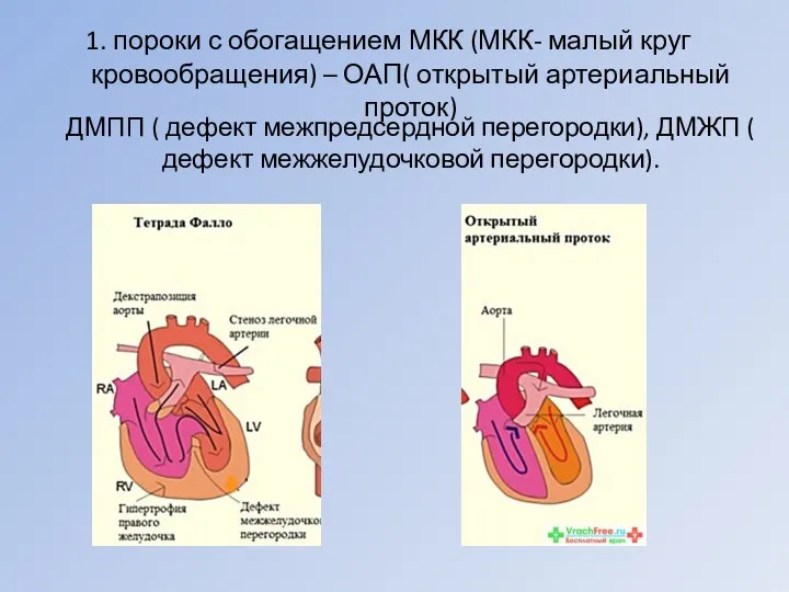 1. пороки с обогащением МКК (МКК- малый круг кровообращения) – ОАП( открытый