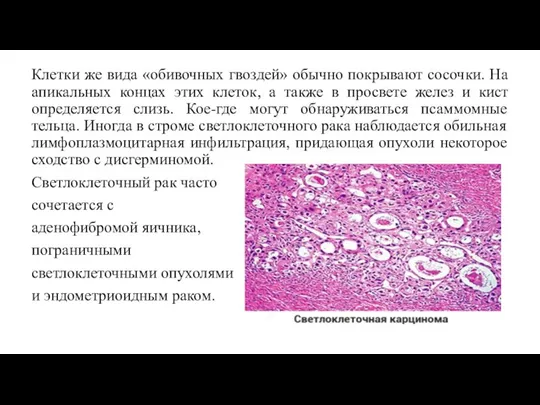 Клетки же вида «обивочных гвоздей» обычно покрывают сосочки. На апикальных концах этих