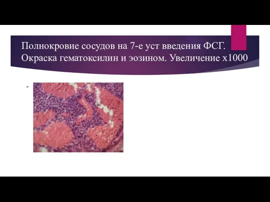 Полнокровие сосудов на 7-е уст введения ФСГ. Окраска гематоксилин и эозином. Увеличение х1000