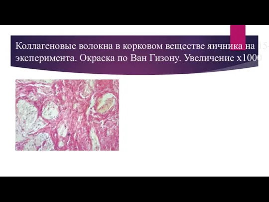 Коллагеновые волокна в корковом веществе яичника на 15-е сут эксперимента. Окраска по Ван Гизону. Увеличение х1000