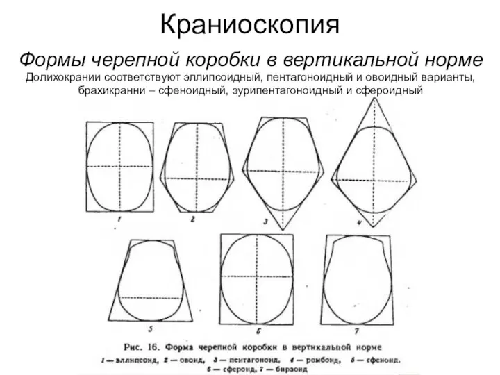 Краниоскопия Формы черепной коробки в вертикальной норме Долихокрании соответствуют эллипсоидный, пентагоноидный и