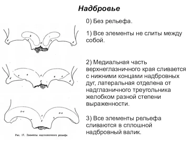 Надбровье 0) Без рельефа. 1) Все элементы не слиты между собой. 2)