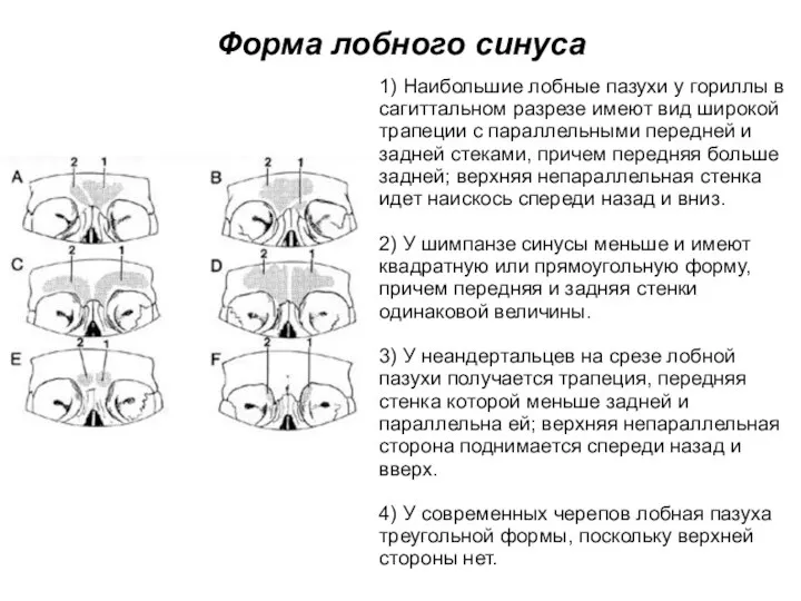 Форма лобного синуса 1) Наибольшие лобные пазухи у гориллы в сагиттальном разрезе