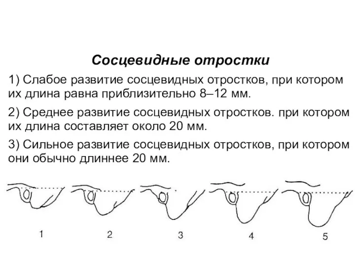 Сосцевидные отростки 1) Слабое развитие сосцевидных отростков, при котором их длина равна