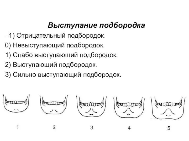 Выступание подбородка –1) Отрицательный подбородок. 0) Невыступающий подбородок. 1) Слабо выступающий подбородок.