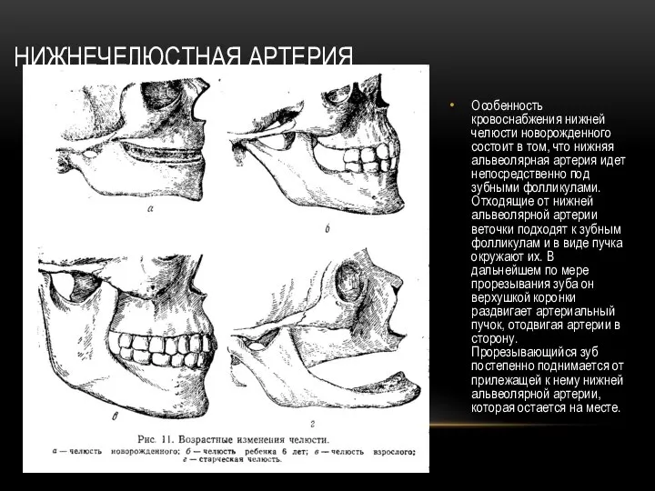 НИЖНЕЧЕЛЮСТНАЯ АРТЕРИЯ Особенность кровоснабжения нижней челюсти новорожденного состоит в том, что нижняя