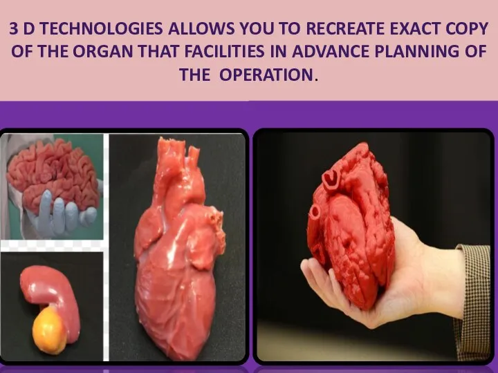 3 D TECHNOLOGIES ALLOWS YOU TO RECREATE EXACT COPY OF THE ORGAN