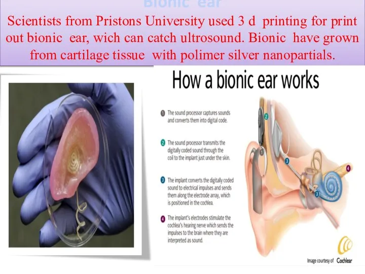 Bionic ear Scientists from Pristons University used 3 d printing for print