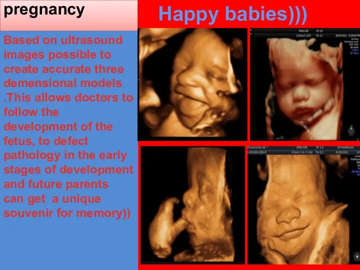 Monitoring of pregnancy Happy babies))) Based on ultrasound images possible to create