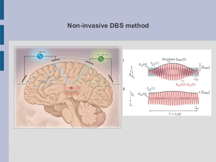 Non-invasive DBS method