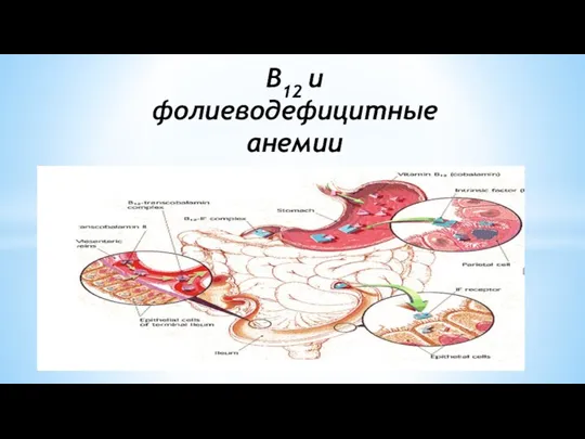 В12 и фолиеводефицитные анемии