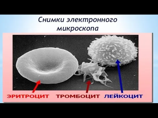 Снимки электронного микроскопа