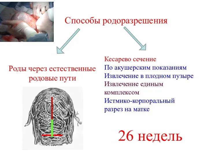 Способы родоразрешения Кесарево сечение По акушерским показаниям Извлечение в плодном пузыре Извлечение