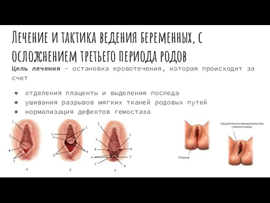 Лечение и тактика ведения беременных, с осложнением третьего периода родов Цель лечения