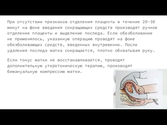 При отсутствии признаков отделения плаценты в течение 20-30 минут на фоне введения