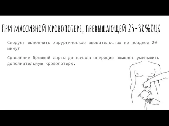 При массивной кровопотере, превышающей 25-30%ОЦК Следует выполнить хирургическое вмешательство не позднее 20