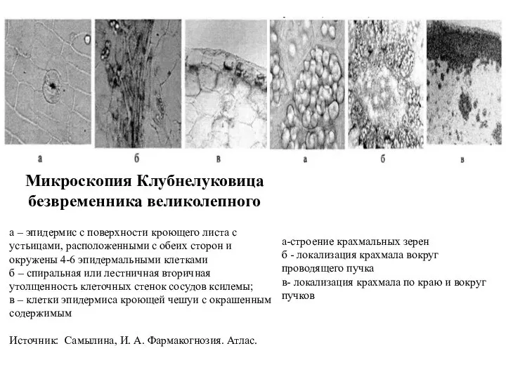 Микроскопия Клубнелуковица безвременника великолепного а – эпидермис с поверхности кроющего листа с